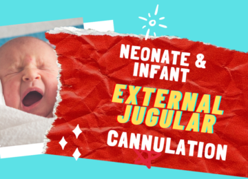 External Jugular